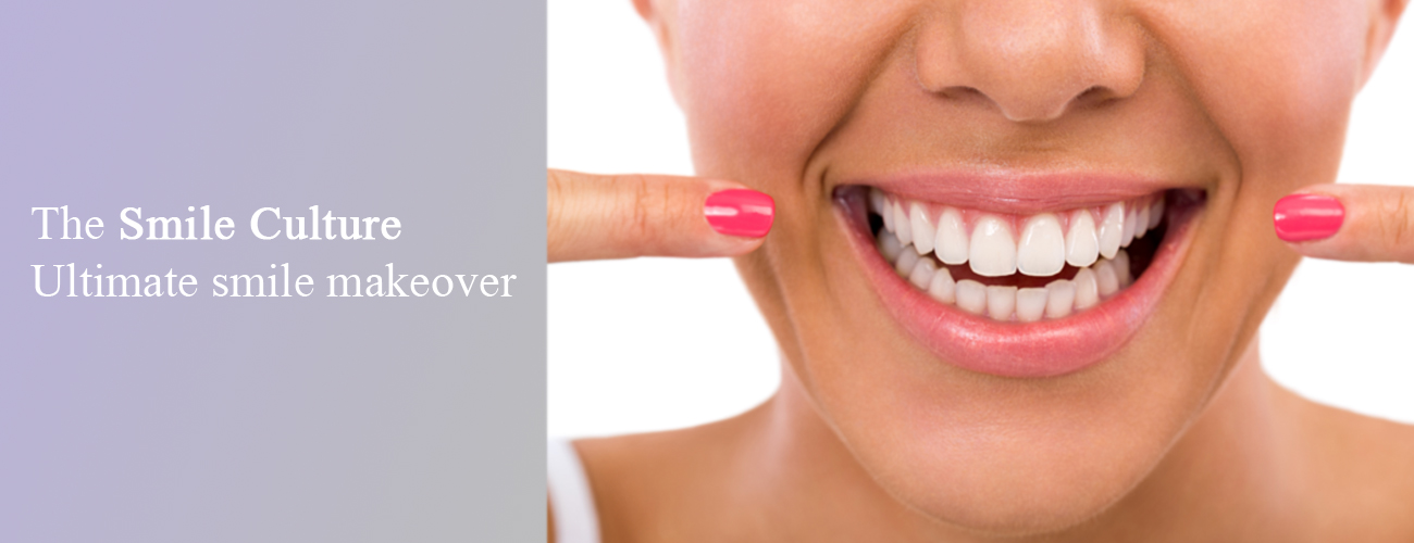 Smile makeover